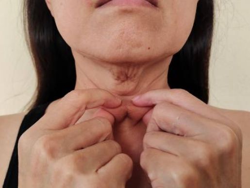 How To Treat Neck Wrinkles? 6 Effective Ways to Treat Them